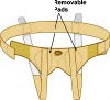 INGUINAL HERNIA REPAIR (3) - 3.1