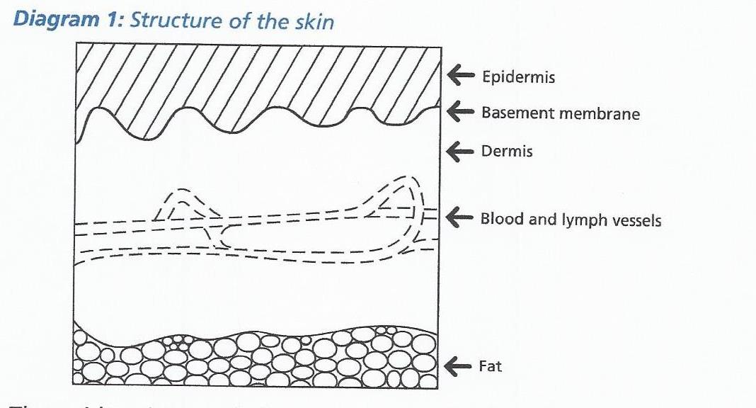 MALIGNANT MELANOMA - 1