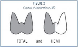 THYROID-SURGERY-2